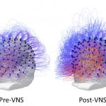 After 15 Years in a Vegetative State, Researchers Partly Restore Consciousness in Patient After 15 Years in a Vegetative State, Researchers Partly Restore Consciousness in Patient