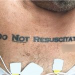 Doctors Baffled By Unconscious Man With ‘Do Not Resuscitate’ Tattoo (Photo) Doctors Baffled By Unconscious Man With 'Do Not Resuscitate' Tattoo (Photo)