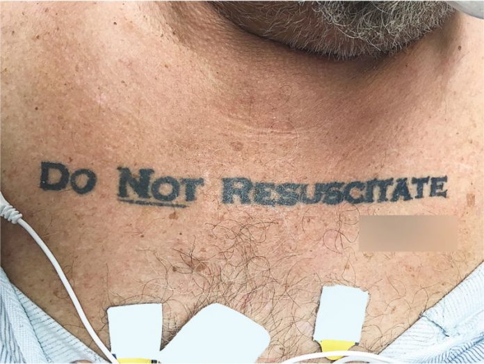 Doctors Baffled By Unconscious Man With 'Do Not Resuscitate' Tattoo (Photo)