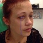 Eyeball Tattoo Leaves Woman In Pain And Partially Blind Eyeball Tattoo Leaves Woman In Pain And Partially Blind