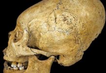 Elongated Skulls Increased Kudos in Ancient Peru, researchers say Elongated Skulls Increased Kudos in Ancient Peru, says new research