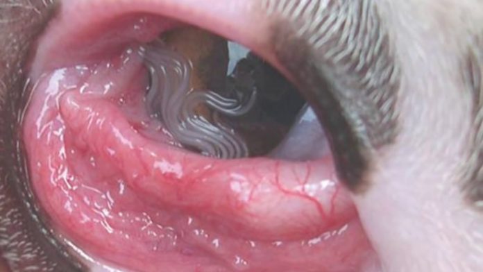 US Woman Finds 14 Worms Living in Her Eye