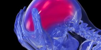 High blood pressure and brain health are linked High blood pressure and brain health are linked