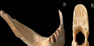 Researchers Studied The Bone Of A Hiroshima Victim. This Is What They Found Researchers Studied The Bone Of A Hiroshima Victim. This Is What They Found