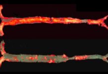 Science: Antibody blocks inflammation, protects mice from hardened arteries and liver disease — (research)