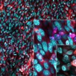 Health: Understanding how tumors subvert elements of our immune system suggests new immunotherapy treatments — (Study)