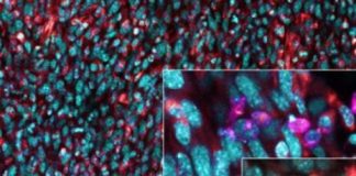 Health: Understanding how tumors subvert elements of our immune system suggests new immunotherapy treatments — (Study)