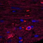 Health: Existing drug dials down inflammation in mice — (Study)