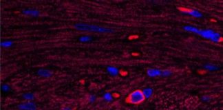 Health: Existing drug dials down inflammation in mice — (Study)