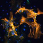 Health: Study surfaces new evidence of an important role for macrophages in HIV-related cognitive impairment — (Study)