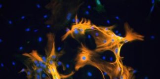 Health: Study surfaces new evidence of an important role for macrophages in HIV-related cognitive impairment — (Study)