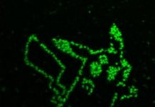 Tech: Measuring metabolites in algae one cell at a time — (Report)