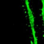 Health: Repeated stimulation enlarges dendritic spines — (Study)