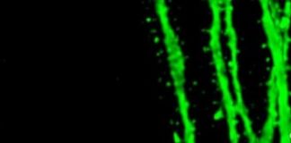 Health: Repeated stimulation enlarges dendritic spines — (Study)