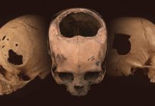 Study: Remarkable skill of ancient Peru’s cranial surgeons — ScienceDaily