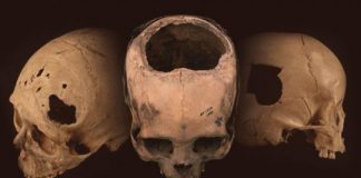 Study: Remarkable skill of ancient Peru’s cranial surgeons — ScienceDaily