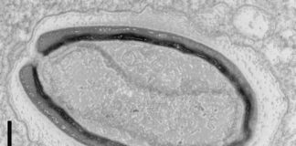 Science: Giant viruses invent their own genes — (research)