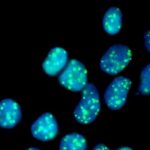 Artificial gene defect reveals target to fight genetic disease — (Study)