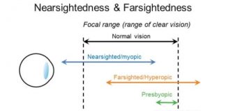 Authors to demonstrate vision-correcting system at SIGGRAPH 2018 — (Study)