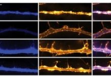 Psychedelic drugs promote neural plasticity in rats and flies — (research)