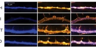 Psychedelic drugs promote neural plasticity in rats and flies — (research)