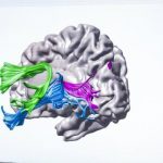 Study: How instruction changes brain circuitry with struggling readers — (Details)