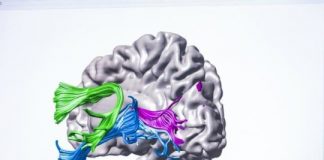 Study: How instruction changes brain circuitry with struggling readers — (Details)