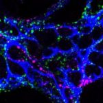 Study: Early source of irritable bowel syndrome discovered — (Details)