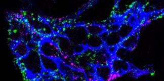 Study: Early source of irritable bowel syndrome discovered — (Details)