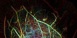 Study: Imaging an entire breast in 15 seconds — (Details)