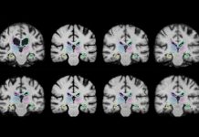 Tech: Faster analysis of medical images — (Report)