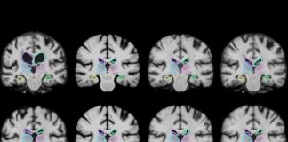 Tech: Faster analysis of medical images — (Report)
