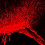 Study: Modulating CHD8 might help some people with complex condition — (Details)