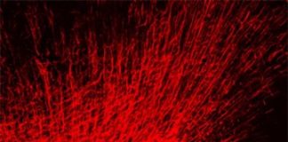 Study: Modulating CHD8 might help some people with complex condition — (Details)