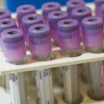 Study: First physiological test for autism proves high accuracy in second trial — (Details)