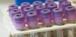 Study: First physiological test for autism proves high accuracy in second trial — (Details)