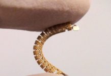 Tech: ‘Smart stent’ detects narrowing of arteries — (Report)