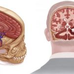 Study: A medical analysis of his injuries and neurosurgical care — (Details)