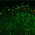 Study: Cells can trap viruses in protein cage to stop their spread, study reveals — (Details)