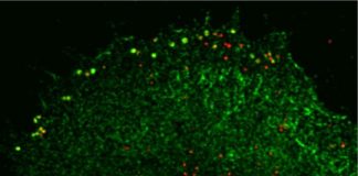 Study: Cells can trap viruses in protein cage to stop their spread, study reveals — (Details)