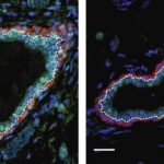 Study: Breast cancer could be prevented by targeting epigenetic proteins, study suggests — (Details)