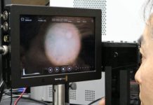Tech: Miniaturized infrared cameras take colored photos of the eye — (Report)