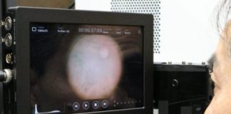 Tech: Miniaturized infrared cameras take colored photos of the eye — (Report)