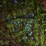 Study: New tissue-imaging technology could enable real-time diagnostics, map cancer progression — (Details)