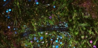 Study: New tissue-imaging technology could enable real-time diagnostics, map cancer progression — (Details)