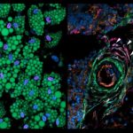 Study: The cells that control the formation of fat — (Details)