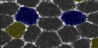 Study: Mechanism behind space expansion of oncogenic mutant cells — (Details)