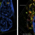 Study: New target to stop cancer growth uncovered — (Details)