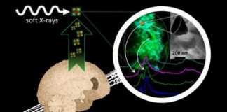 Study: In brains affected by Alzheimer’s, researchers identify chemically reduced iron species, with mineral forms including a magnetic iron oxide — (Details)
