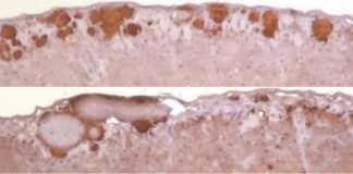 Study: Prion replication under low-RNA conditions results in altered disease features in animals — (Details)